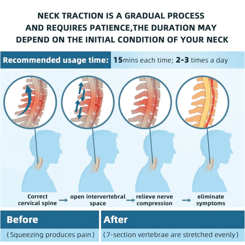 シリオス Gen-2 ネックトラクションカラー